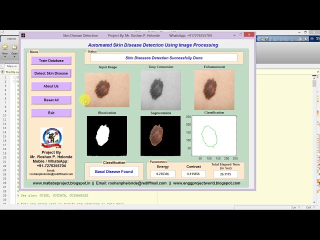 Skin Disease Detection and Classification Using Image Processing Matlab Project Code