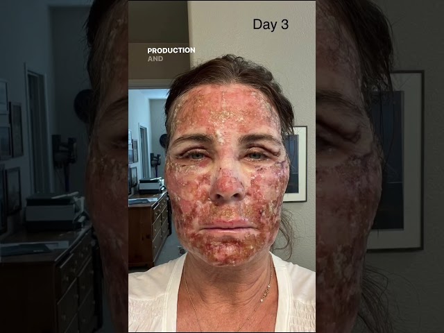 Anti-Aging? THIS is How You Can Reverse the Effects of Aging