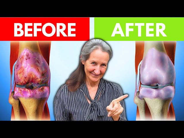 HEAL Joint Pain And Arthritis VERY FAST In 1 WEEK! | Barbara O'Neill
