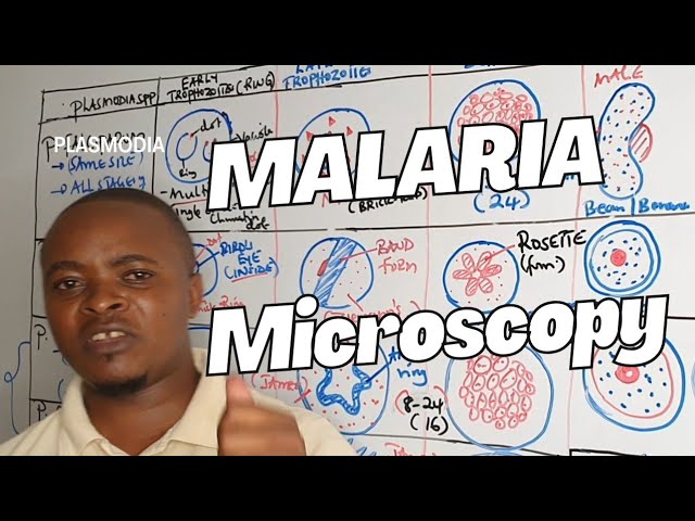 Malaria Microscopy || plasmodia morphology | Lab diagnosis- Parasitology 