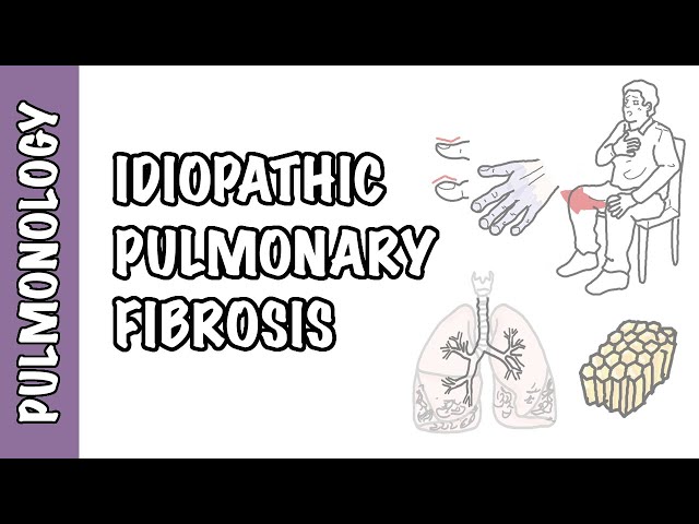 Idiopathic Pulmonary Fibrosis - pathophysiology, signs and symptoms, investigation and treatment