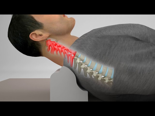 Cervical Denneroll Patient User Guide