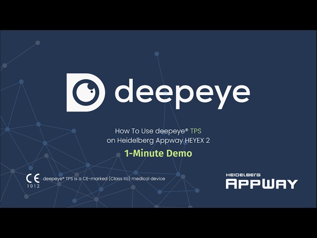 How To Use deepeye® TPS | Heidelberg AppWay HEYEX 2 | 1-Minute Demo