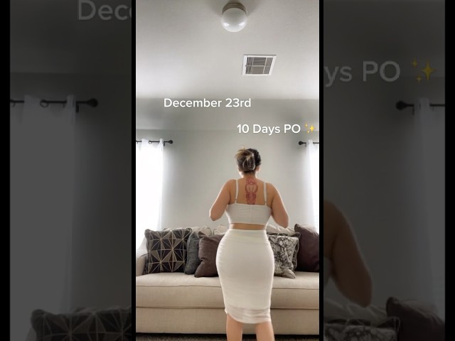 10 Days Post-Op BBL Results 🤩