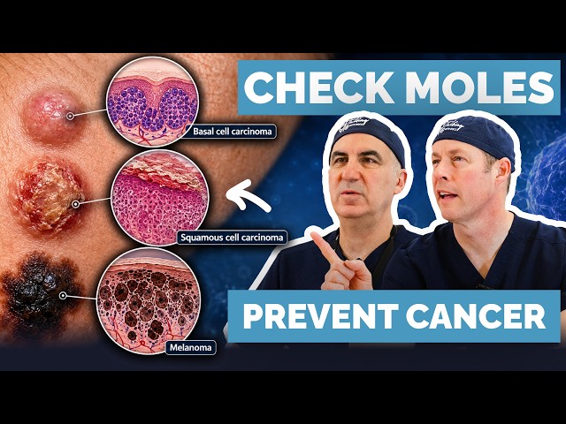 5 Ways to Catch Skin Cancer Before It Spreads