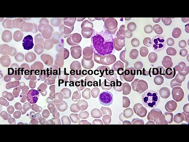 Differential Leucocyte Count DLC Practical Lab