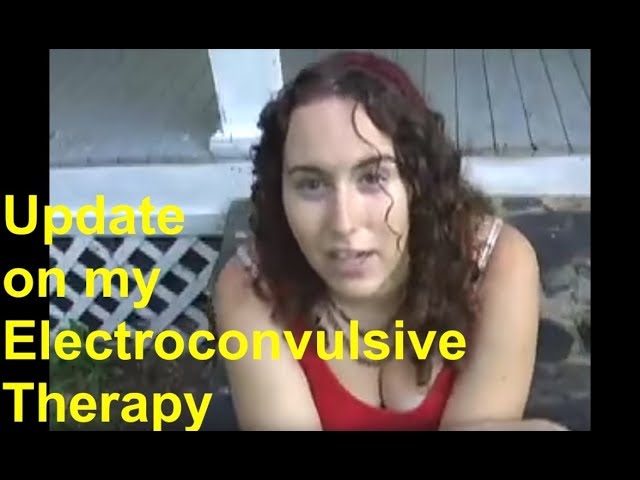 ElectroConvulsive Therapy Update⬅