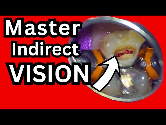 Master Indirect Vision - One of the Hardest Beginner Dental Skills
