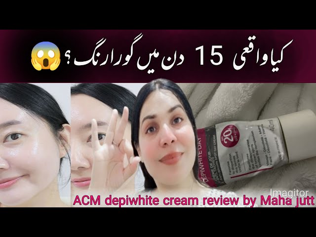 ACM Depiwhite Review | Whitening Cream Without Side Effects?