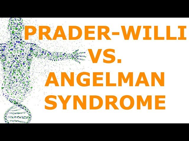 Síndrome de Prader-Willi vs. Síndrome de Angelman (Impresión)