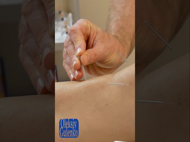 Fascinating World of Acupuncture ASMR