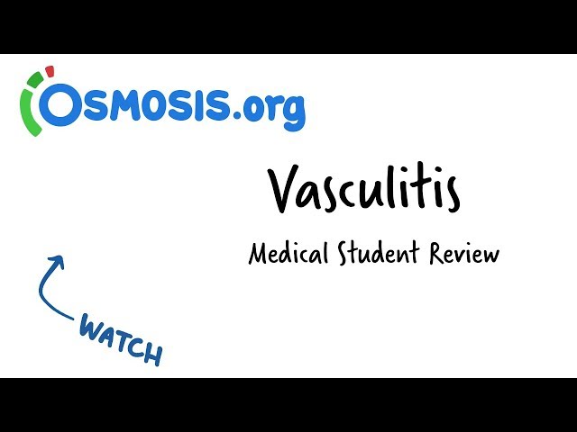 Vasculitis | Clinical Presentation