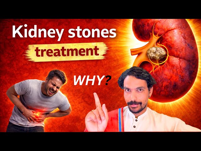 KIDNEY STONES | Kidney Stone Is NOT a Stone Problem | Real Root Cause | @PrashantjYoga 