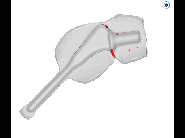 Closed-die forging simulation of a femoral implant with folds detection - FORGE®