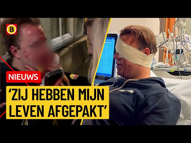 Duke (21) gaat mentaal en fysiek achteruit na mishandeling | Omroep Brabant