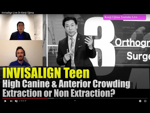 #7 Invisalign Youtube Live in English [Dr. Kenji Ojima]