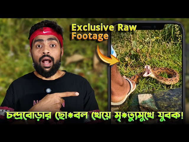 নির্বিষ সাপ ভেবে Russell’s Viper ধরতে গিয়ে কি হলো দেখুন! ছো*বল খেয়ে মৃ*ত্যুর সাথে লড়ছে যুবক!