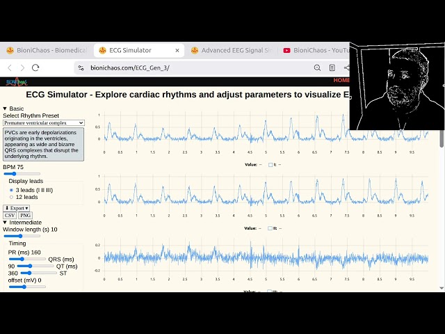 Building Realistic EEG & EMG Simulations with AI: Stochastic Signal Processing