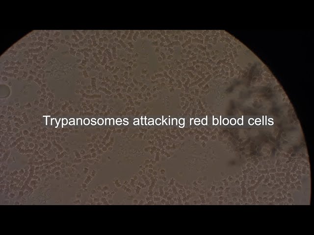 Trypanosomes attacking red blood cells