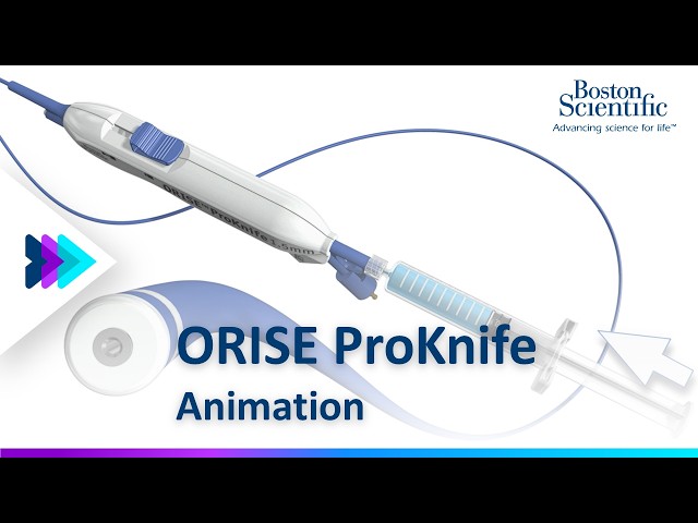 ORISE™ ProKnife Animation | Boston Scientific