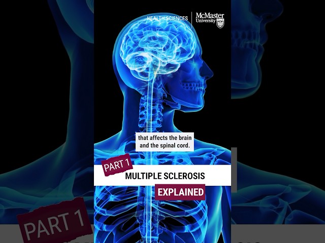 PT1: Multiple Sclerosis Explained: Here’s what you need to know about MS #multiplesclerosis #shorts