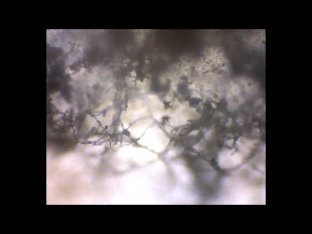 Mold under Microscope