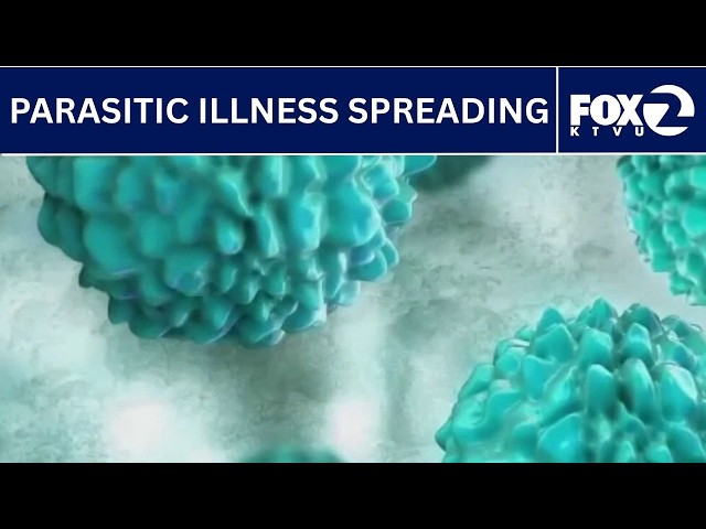 Parasite causing major stomach symptoms is spreading | KTVU