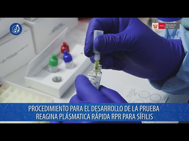 Desarrollo de la prueba Reagina Plásmatica Rápida (RPR) para el diagnóstico de Sífilis