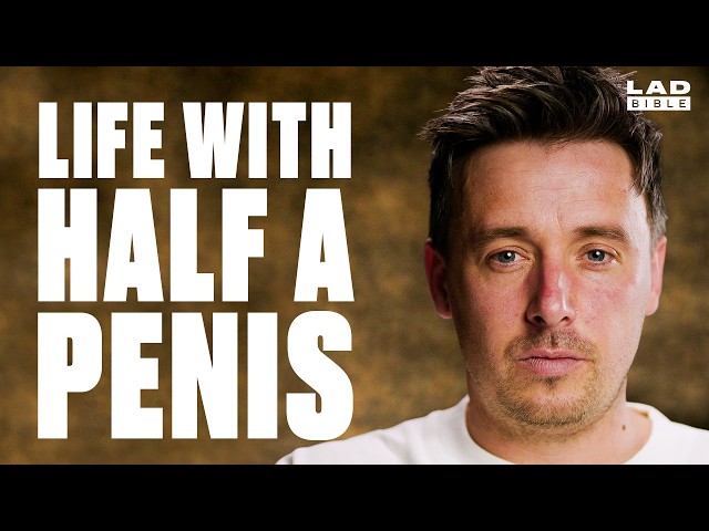 I Had Four Inches of My Penis Removed | Minutes With