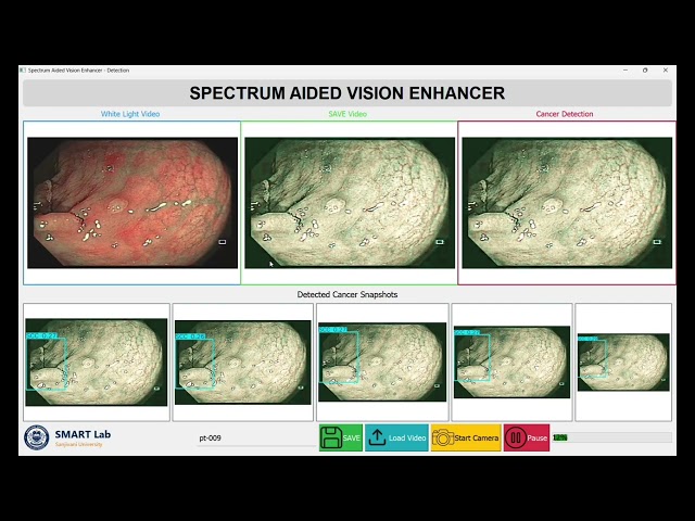 HyperLuma 26198 - SAVE: Spectrum-Aided Vision Enhancer for AI-Assisted Early Cancer Detection.