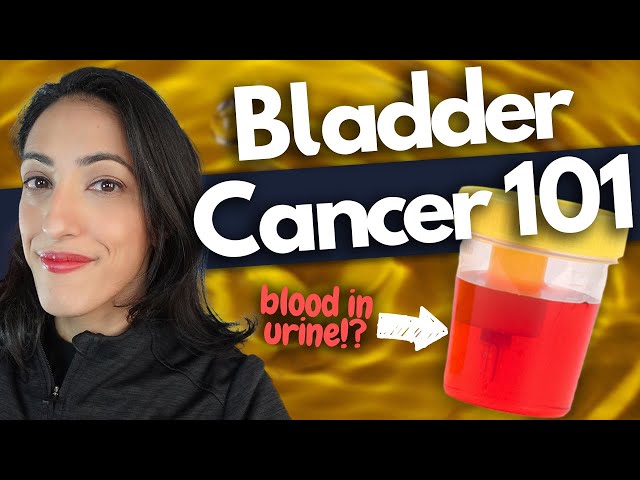 Bladder Cancer 101 | Symptoms, Diagnosis & Treatment