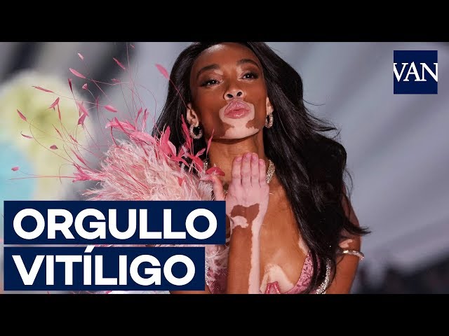 [Victoria's Secret 2018] Winnie Harlow, la primer modelo con vitíligo en desfilar