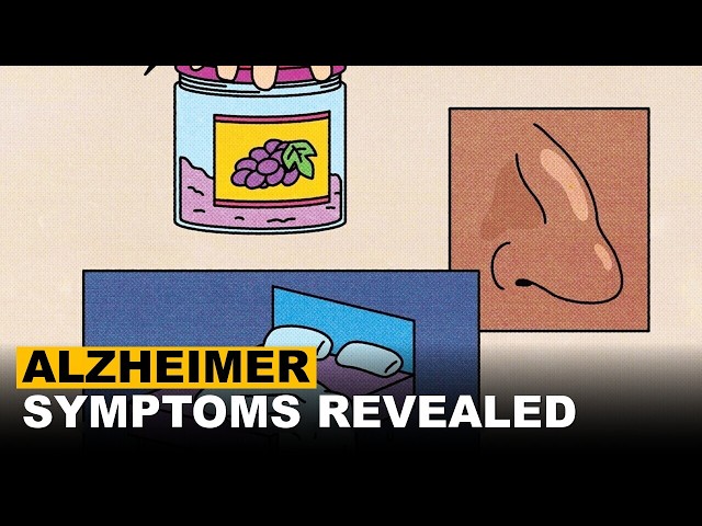 Dementia Expert Reveals New Strategy To Identify Early Alzheimer Symptoms