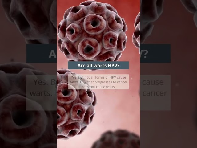 HPV & Warts: What you need to know | #MCAShorts