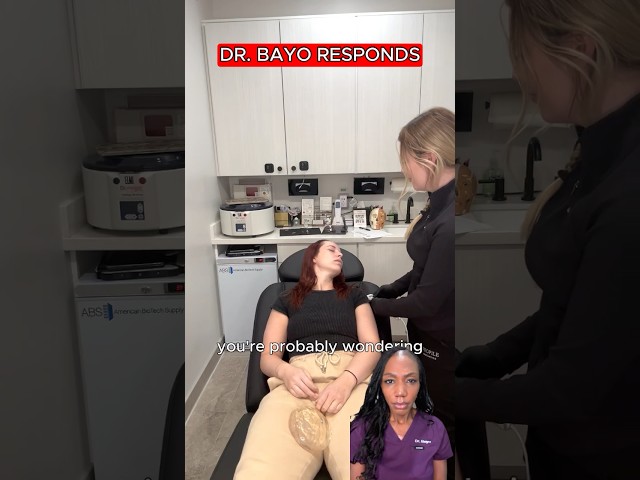 She Fainted After Botox — Here’s What a Vasovagal Response Really Is | Doctor Explains