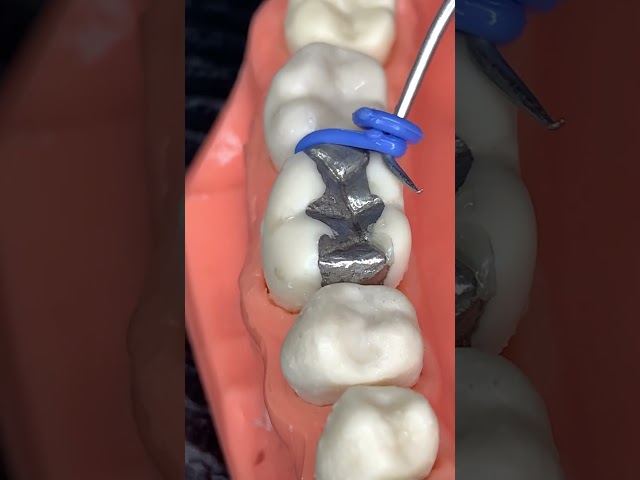 🔥ESPACIADORES DENTALES🔥