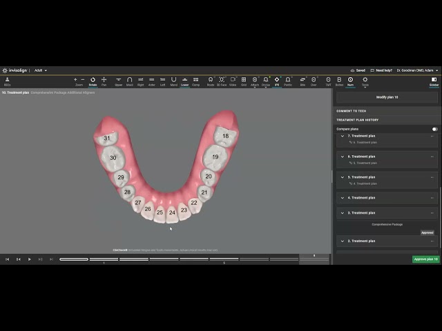 TOOTH NUMBERING SYSTEM- A QUICK REVIEW