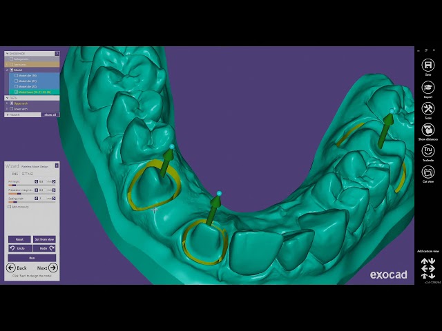 Form 3B - Solid Models with Working Dies in ExoCAD Model Creator