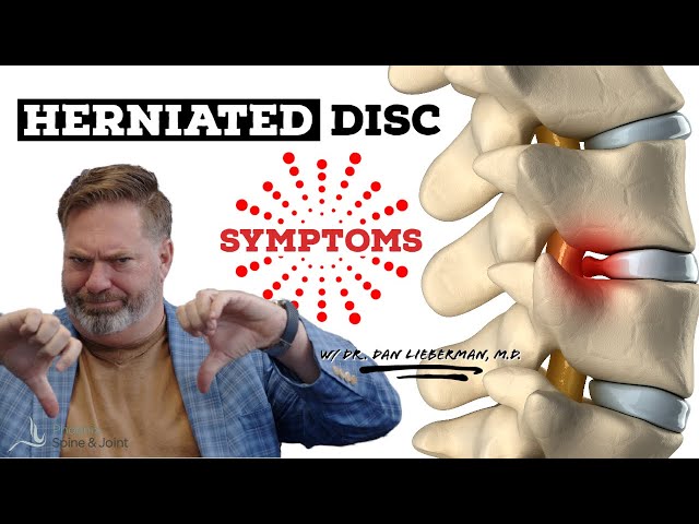 The #1 Sign Of A Herniated Disc Is THIS!
