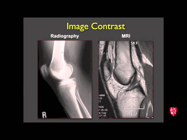 Medical Student Lecture: Introduction to Musculoskeletal Imaging