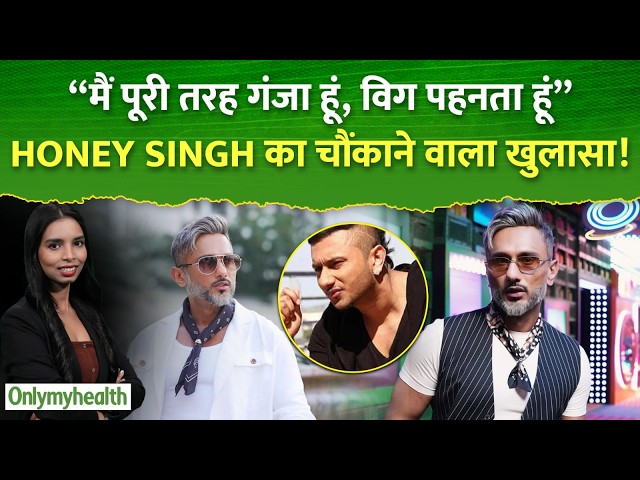 Honey Singh Hair Loss Story: क्या Hair Loss के बाद Wig पहनते हैं Honey Singh? जानिए बाल झड़ने की वजह