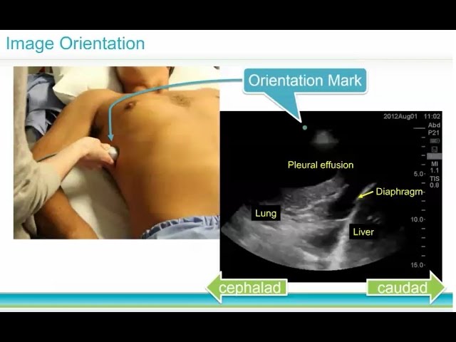 Ultrasound Basics -- BAVLS