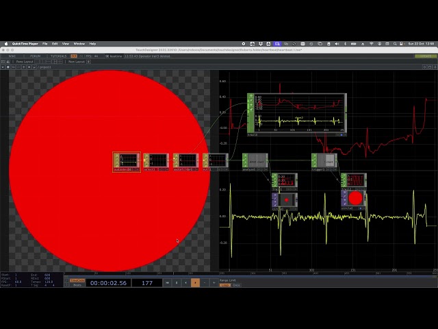 Processing of ECG to visualize heartbeats in TouchDesigner