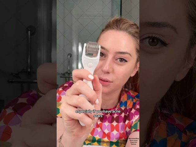 Truth About Microneedling #microneedling #acnescars #skintexture