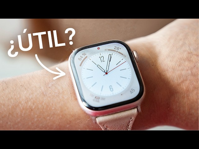 My experience with the Apple Watch Series 10 ⌚️ Is it worth it? ⟡ Reasons, SE comparison, my opin...