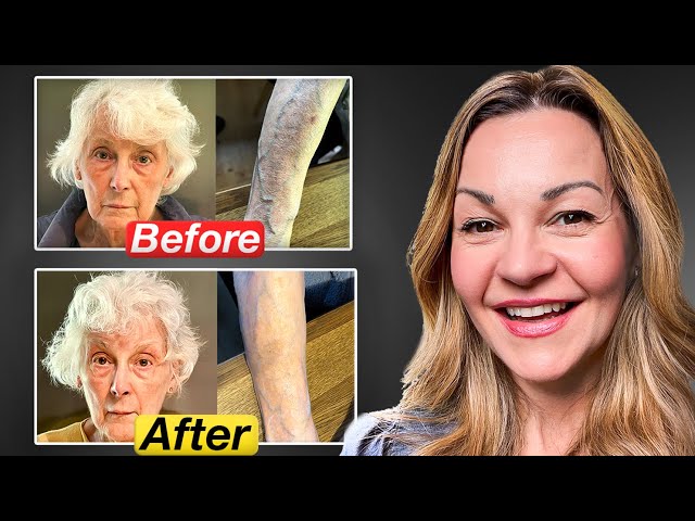 Moisturizers that Repair the Skin Barrier AND Reduce Inflammation! Ageless Skin Guide