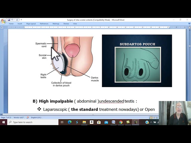 Surgery of testis & scrotum in Arabic 4 ( Undescended testis , part 3) , by Dr.Wahdan .