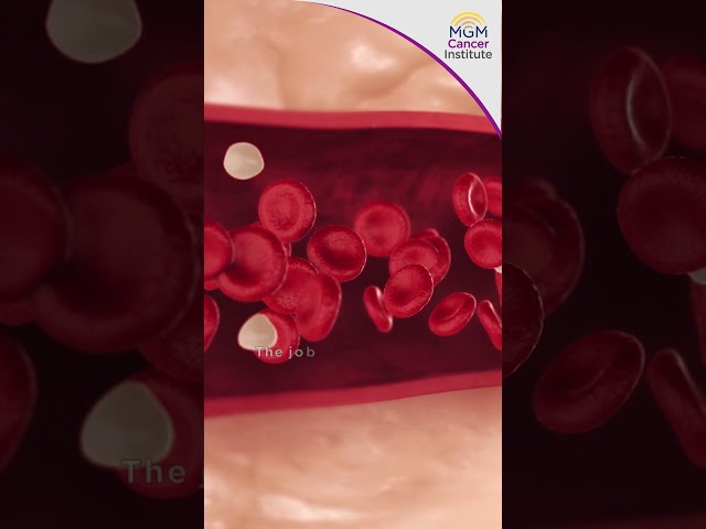 Acute myeloid leukemia (AML)