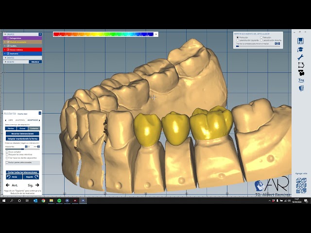 EXOCAD for BEGINNERS, what is it?