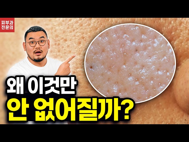Why Your Pores Won’t Shrink | What Actually Works? | Dr. DTS